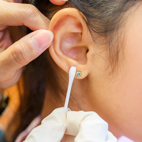Prevent Kids Ear Piercing Allergies - Medical Piercing Clinic